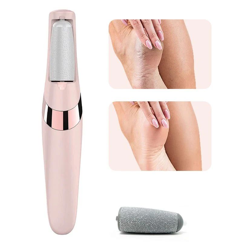 Foot Callus Remover