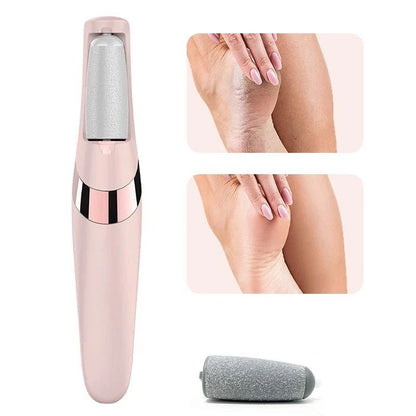 Foot Callus Remover